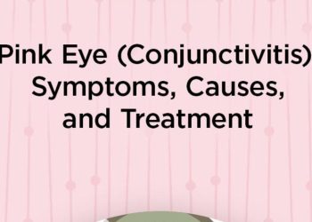 Useful tips for protecting your eyes from conjunctivitis